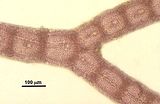 3 – Corticazione a livello di una pseudodicotomia
